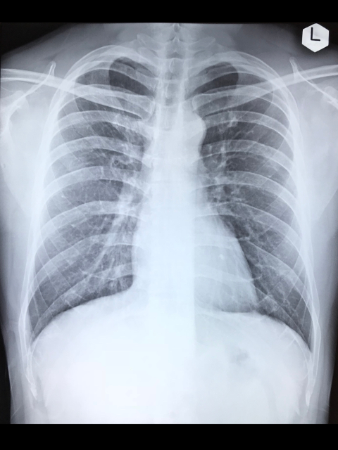 Meditrina Chest X-Ray